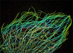 Tiny strands of tubulin, a protein in a cell’s skeleton