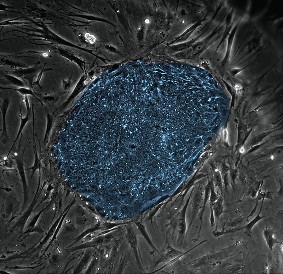 Human embryonic stem cells