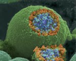 Colorized scanning electron microscope image of a nerve ending that has been broken open to reveal the synaptic vesicles (orange and blue) beneath the cell membrane.